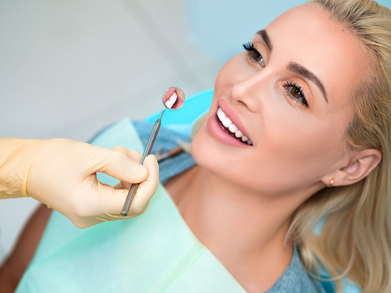 Porcelain Veneers West Covina CA